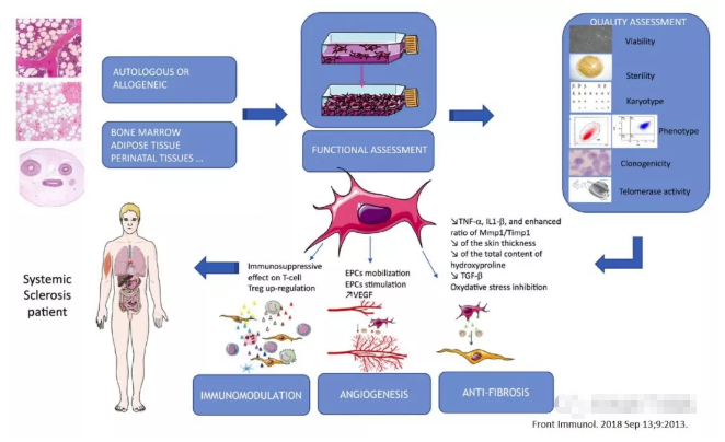 干细胞治疗系统性硬化病，安全且有效
