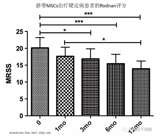 干细胞治疗系统性硬化病,安全且有效