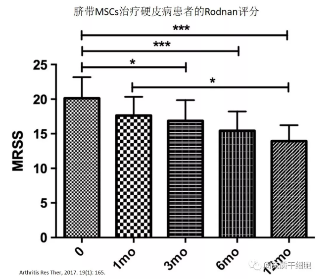 干细胞治疗系统性硬化病，安全且有效