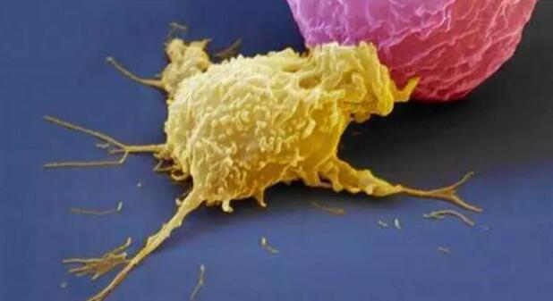 NK细胞免疫细胞疗法效果如何？