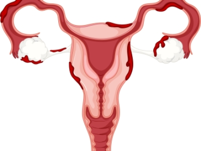 长期节食，对卵巢的影响有多大？