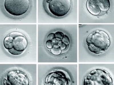 EET胚胎促进疗程主要解决什么问题？